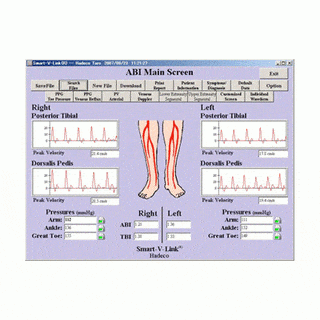 Hadeco Doppler Accessories Hadeco Smart-V-Link Software Version 2