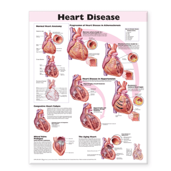 Anatomical Chart Company Anatomical Charts Heart Disease Anatomical Chart