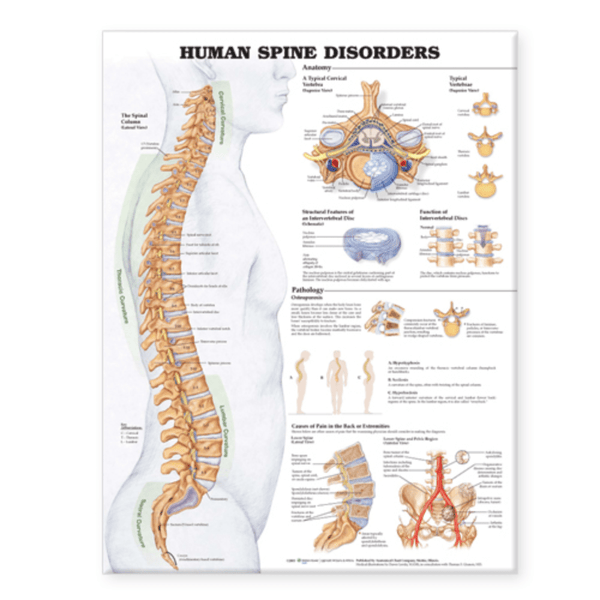 Anatomical Chart Company Anatomical Charts Human Spine Disorders Anatomical Chart