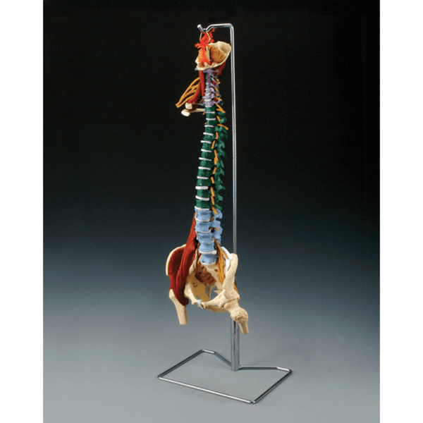 Anatomical Chart Company Anatomical Model Muscle Spine With Disorders with Stand