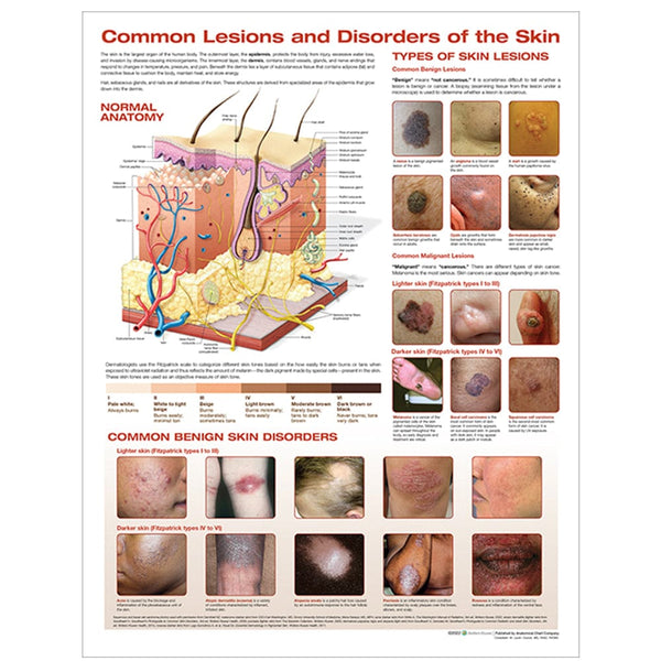 Anatomical Chart Company Anatomical Charts The Skin and Common Disorders Anatomical Chart