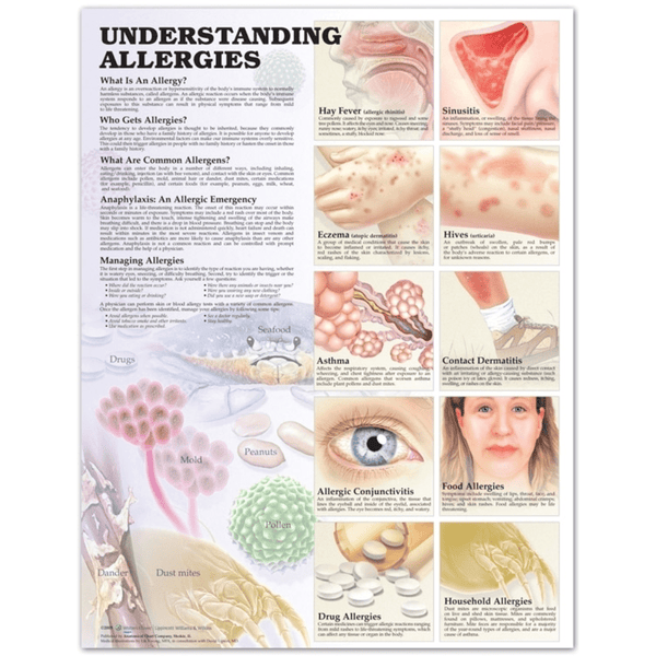 Anatomical Chart Company Anatomical Charts Understanding Allergies Anatomical Chart