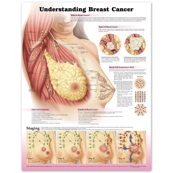 Anatomical Chart Company Anatomical Charts Understanding Breast Cancer 3E Paper