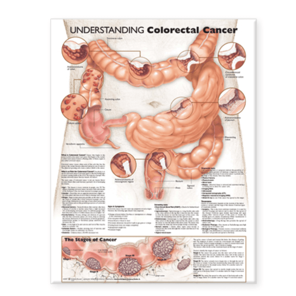 Anatomical Chart Company Anatomical Charts Understanding Colorectal Cancer Anatomical Chart