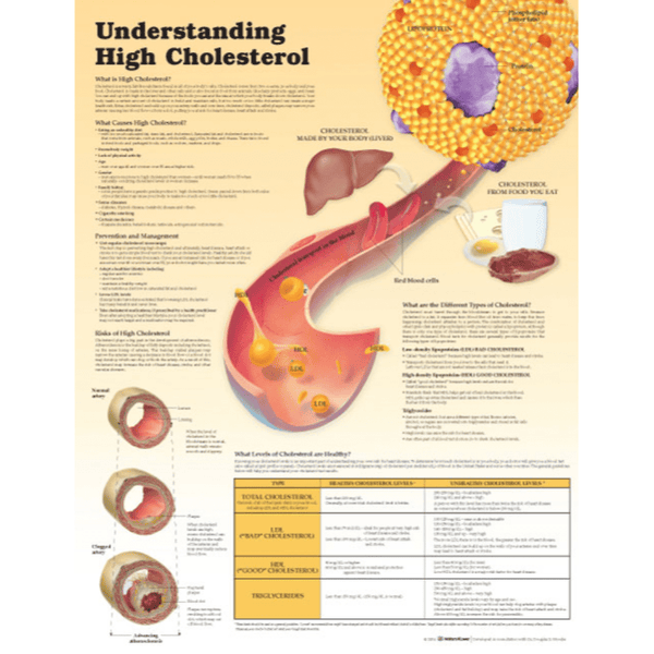 Anatomical Chart Company Anatomical Charts Understanding High Cholesterol Paper  None  Paper