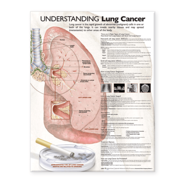 Anatomical Chart Company Anatomical Charts Understanding Lung Cancer Anatomical Chart