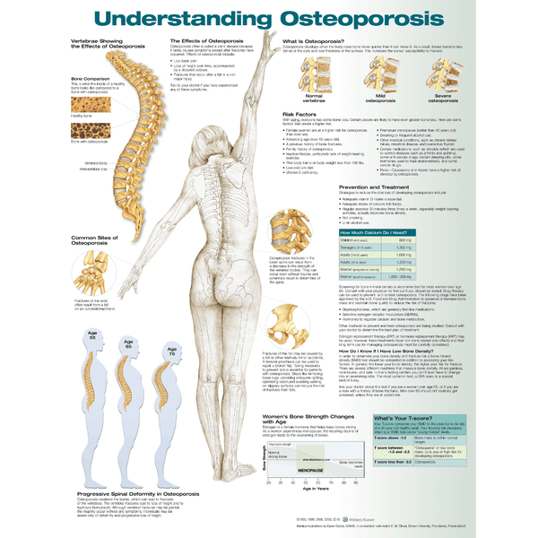 Anatomical Chart Company Anatomical Charts Understanding Osteoporosis