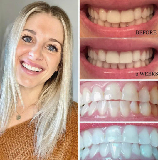 boutique whitening toothpaste