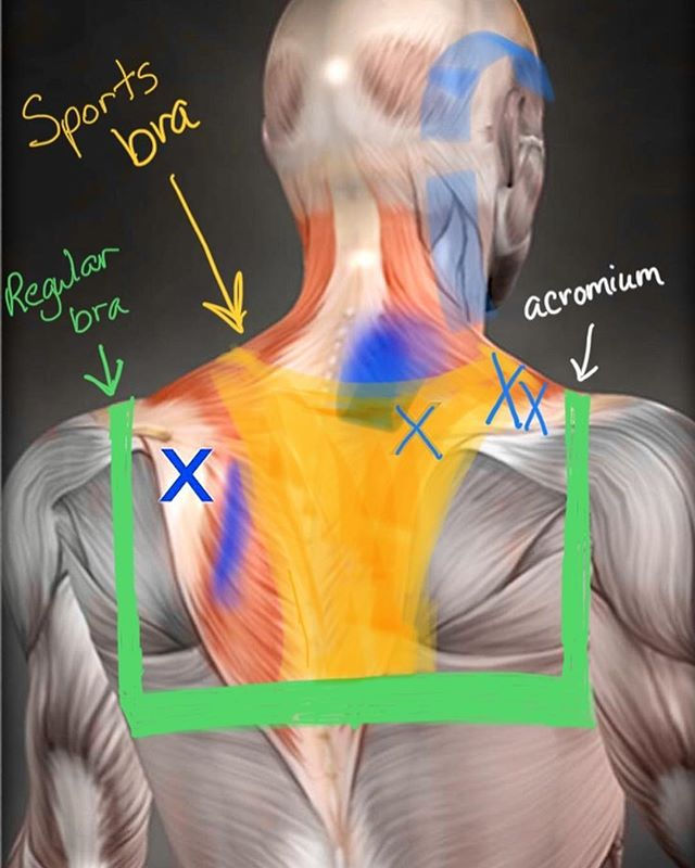 Can wearing bras cause shoulder pain? If so, what bras are best