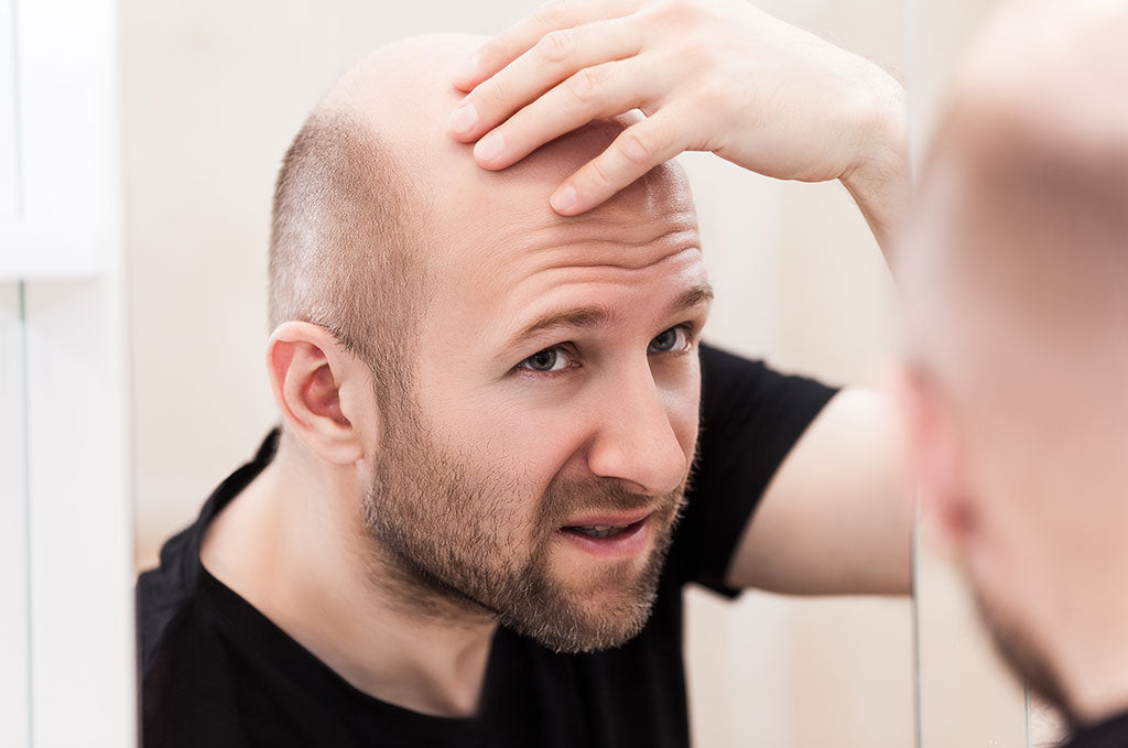 Man Touching Bald Head