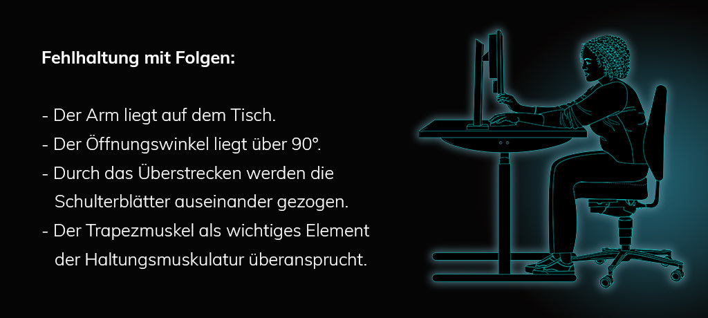 Auch mit einem guten Gaming Stuhl ist noch nicht alles gewonnen. Deine Haltung bildet die Grundlage dafür, ob dein Trapezmuskel überlastet und ob es dann zu kalten Fingern kommt. Daher ist es wichtig, dass du deine Armlehnen richtig einstellst und nutzen. 