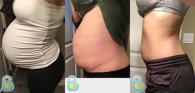 Get My Figure Back In 1 Month After Birth Bellefit Postpartum Girdle