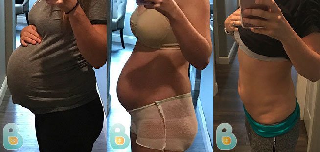 Absolute Game Changer Bellefit Postpartum Girdle