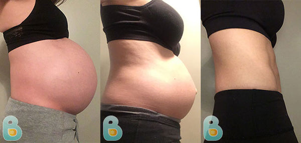 Bellefit postpartum girdle before and after