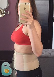 Postpartum abdominal binders
