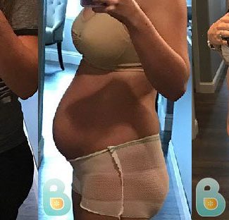 Absolute Game Changer | Bellefit Postpartum Girdle