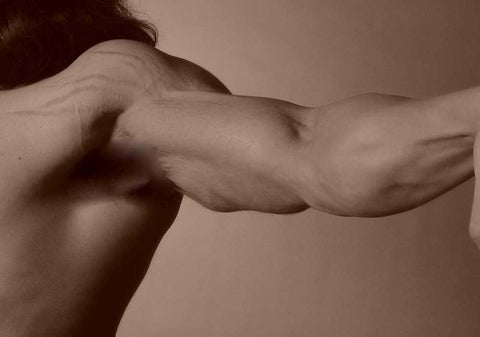 bodybuilder stretch marks