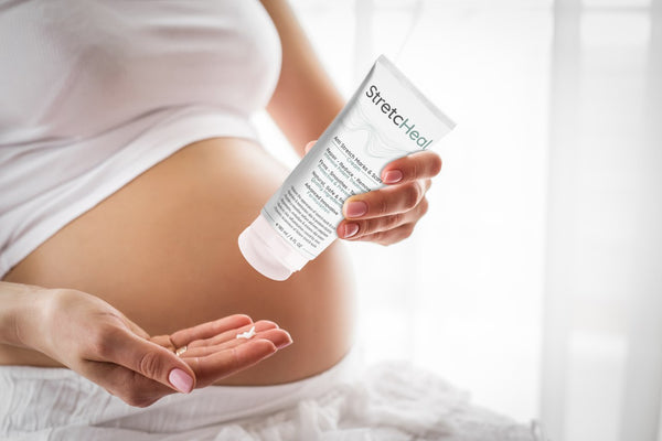 prevent stretch marks during pregnancy