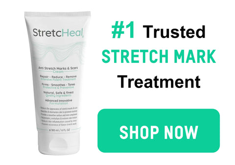 StretcHeal Stretch Marks Cream