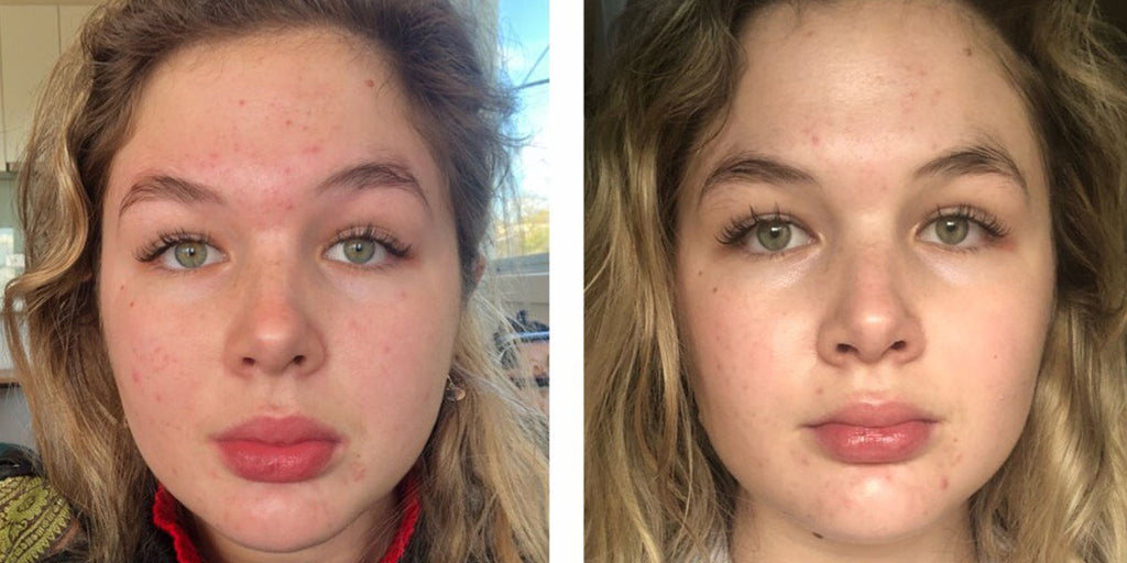 Before and after face image