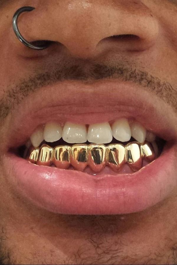 gold teeth