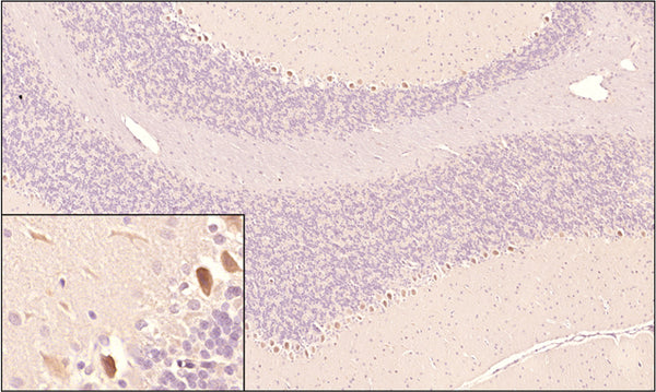 SARM1 IHC