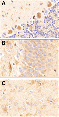 CSPG4/NG2 IHC