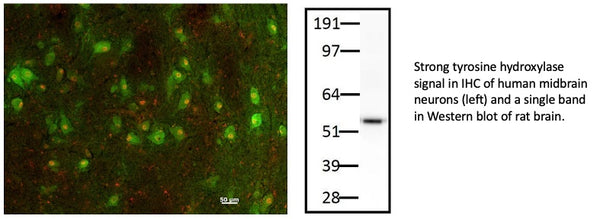 tyrosine hydroxylase