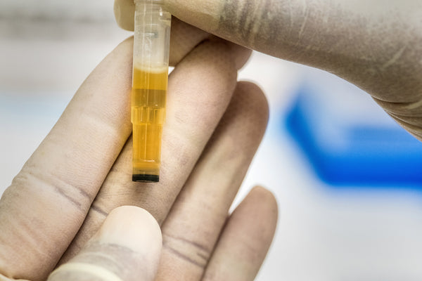 Test delle urine