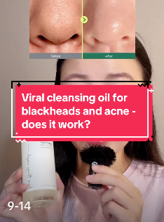 Oil Cleansing Tiktok trend