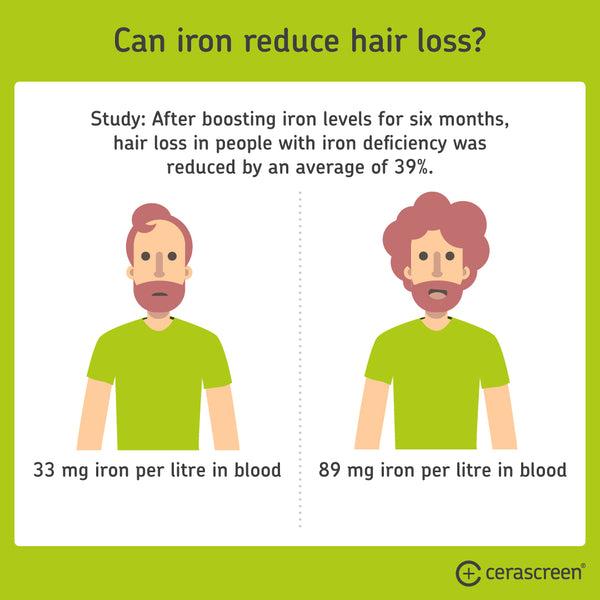 Iron deficiency symptoms: Can iron prevent hair loss?
