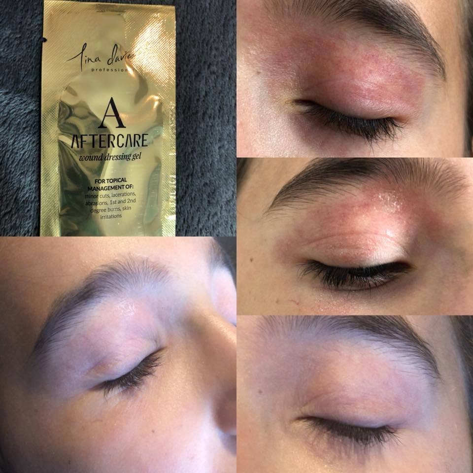 Permanent Eyeliner Aftercare WetDry Healing Day by Day