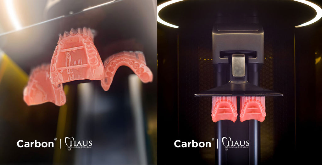 carbon lucitone digital 3D printed dentures