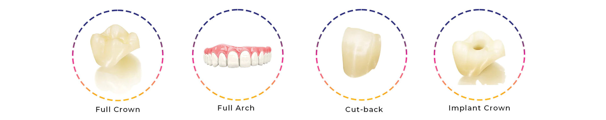 3D Multilayered Zirconia Crown Indication
