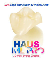 Haus ML 3D Pro Crown