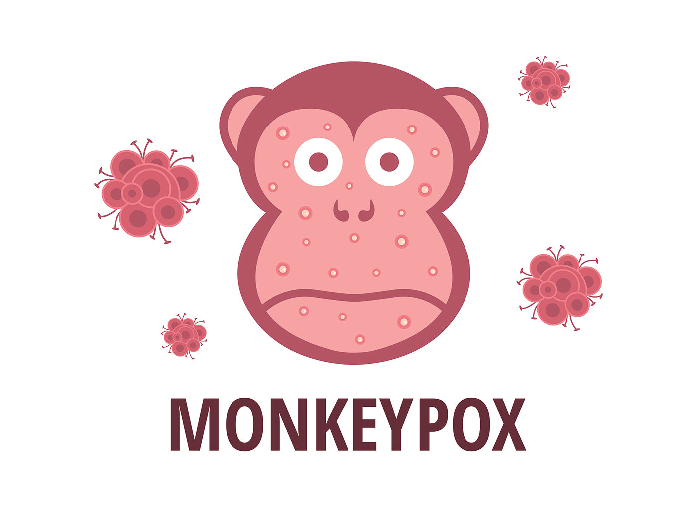 Monkeypox: What you need to know as a parent