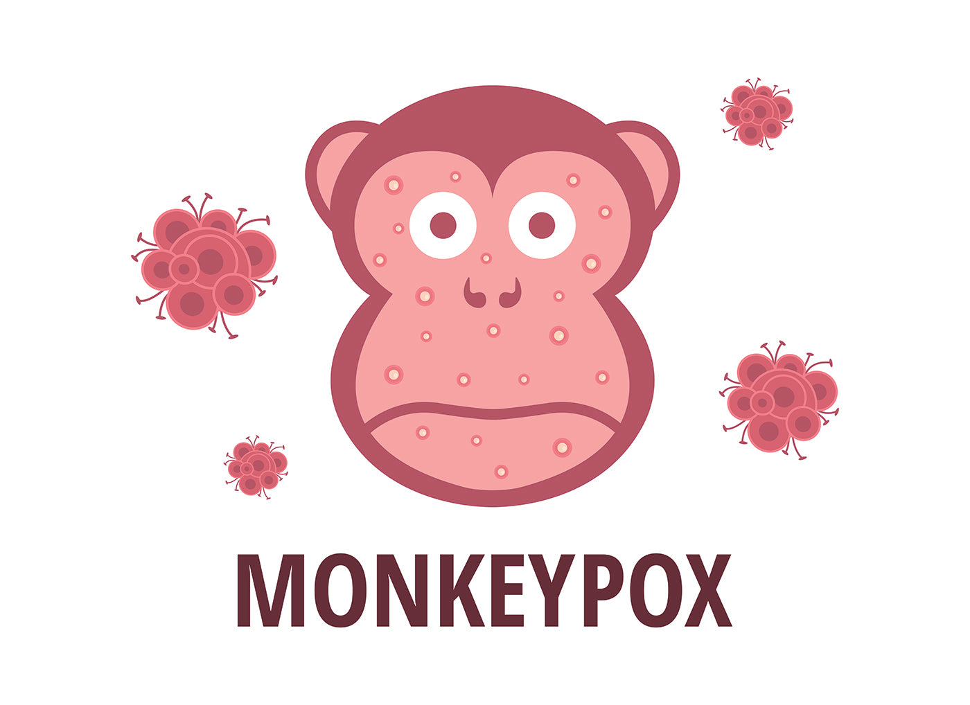 Monkeypox