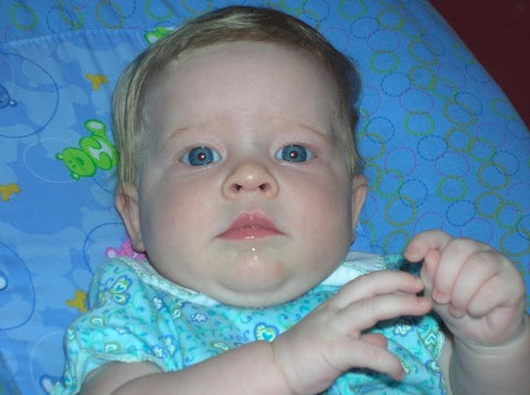 Picture of a baby with blue eyes against a blue background. 3 month old with Neonatal Diabetes