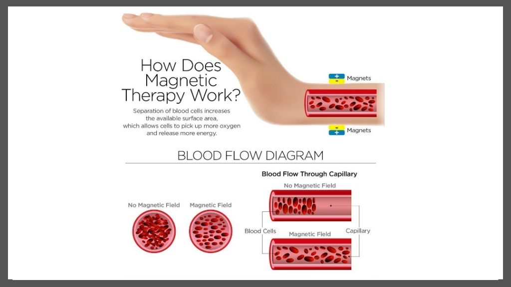 How Does Magnetic Therapy Work | Access Possibilities