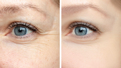 why your eyes wrinkle