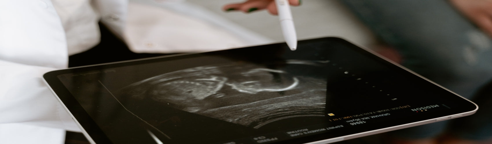 fetal ultrasound