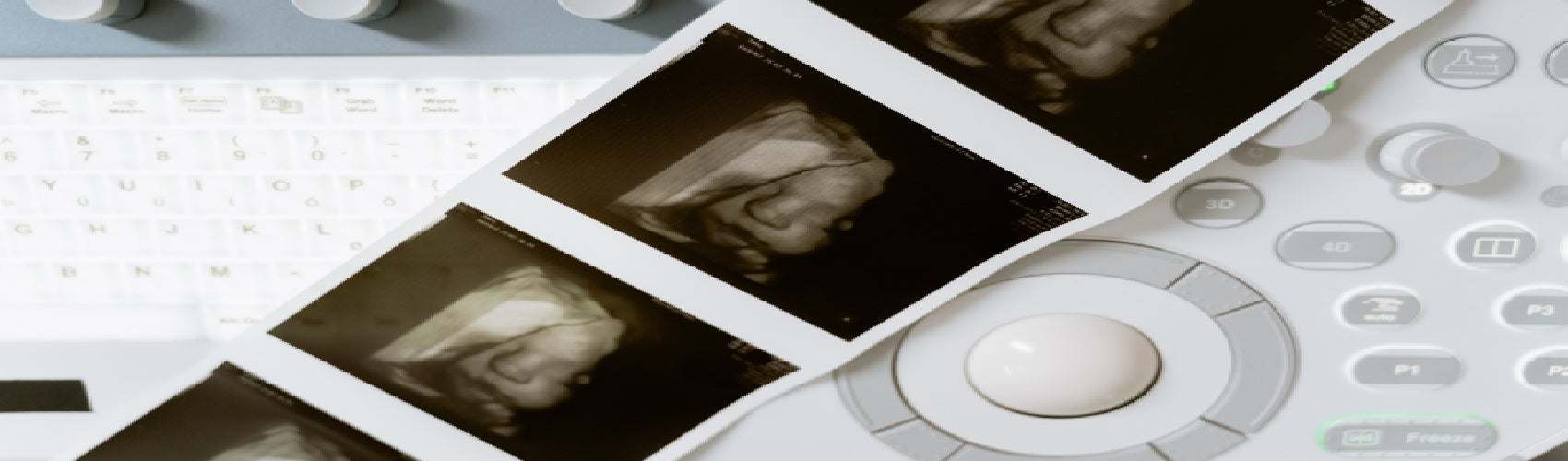 thir trimester ultrasound