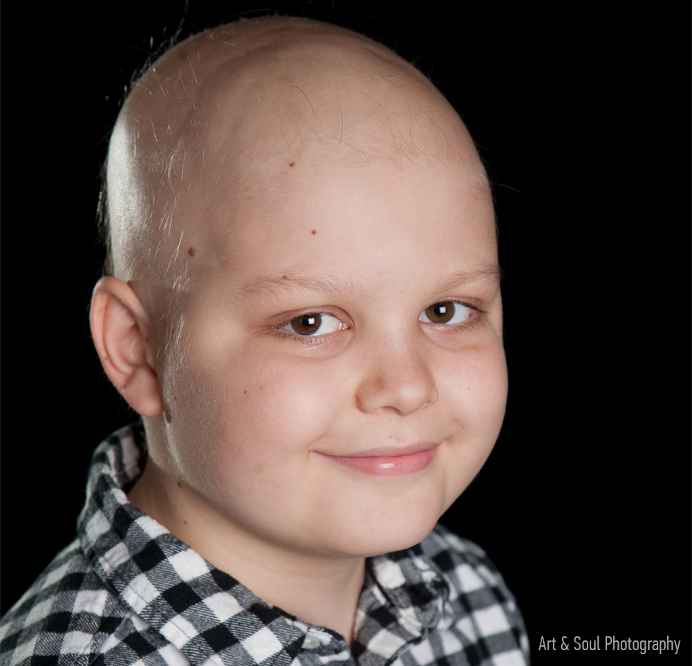 Peyton Armstrong with a bald head during his childhood cancer chemotherapy treatment