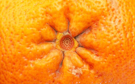 Peau d'orange comme anus-Luckyprize