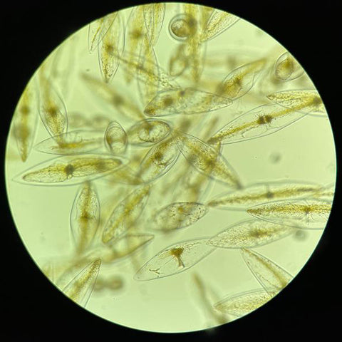 PyroDino phytoplankton under a microscope