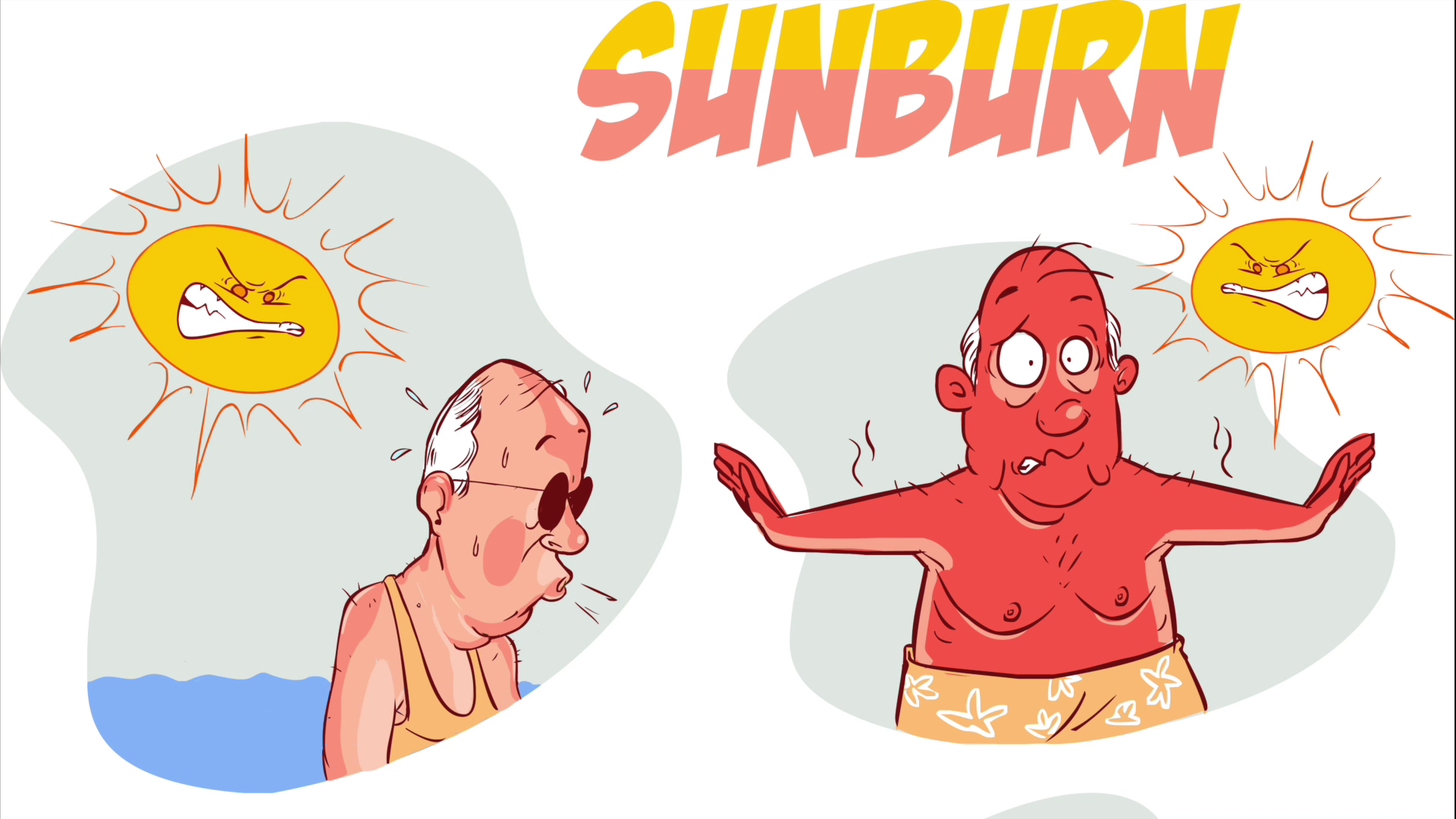 sunburn