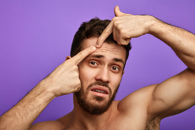a man popping a pimple on his head