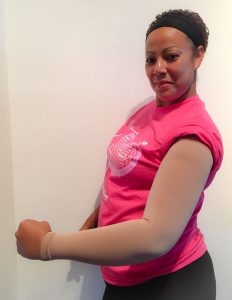 BrightLife Direct Komen Armsleeve Program for Lymphedema