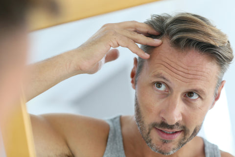 middle aged man with hair loss