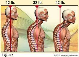 Forward head projection make the weight of the head intensify photo